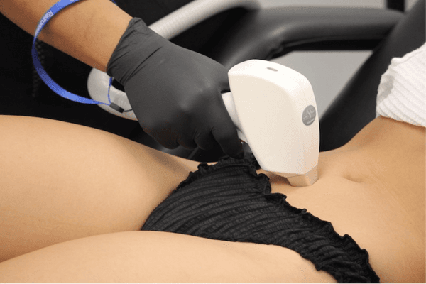 6 Laser Hair Removal Sessions - Medium